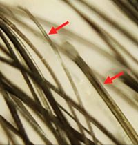 Tu tratamiento capilar, a un clic